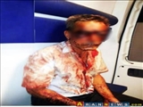 Azərbayjanda hüquq müdafiəçisi ölümünə döyüldü
