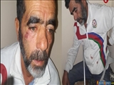 Qarabağ əlili: Polis şöbəsində məni öz əsamla döydülər
