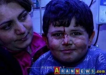 Gəncədə yaralanan uşaq: "Daşın altında qaldım"